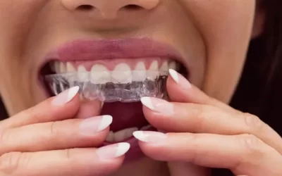 Invisalign Chatsworth: Clear Aligner Therapy for Discreet Orthodontic Correction